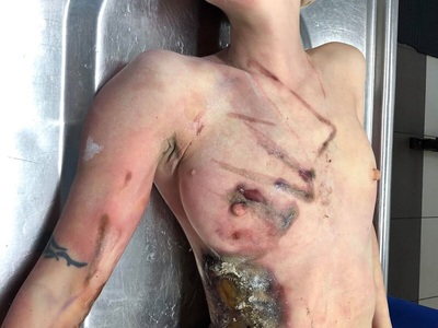 Dead body of young Russian woman died electrocuted 