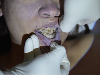 Examination corps of dead Chinese woman killed in hotel room 