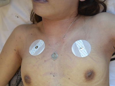 Examination corps of dead Chinese woman killed in hotel room 