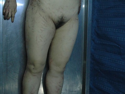 Examination corps of dead Chinese fat woman 