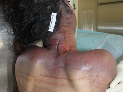 Examination nude dead corps of Chinese young women 