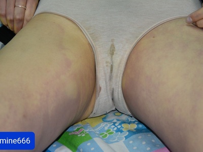 young woman died in her bed due to heart attack 