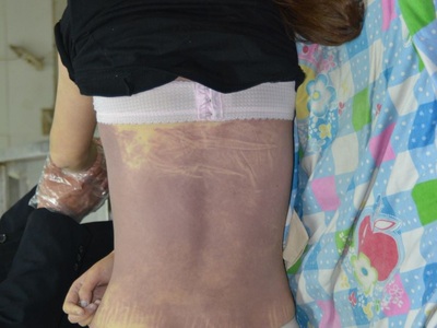 young woman died in her bed due to heart attack 