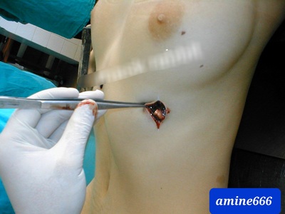 Nice boobs young woman shoot dead