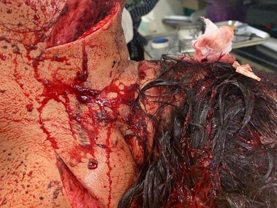 Haitian woman gored byhusband forfucking another man whenhewas jailed 