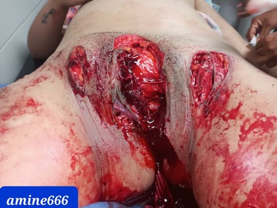 Pedophile castrated and gets a fatal machete to the face 