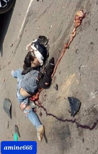 Chinese girl crashed dead under big truck