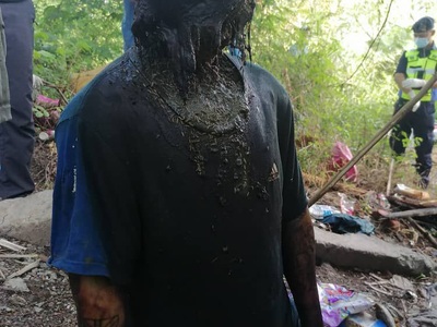 Hanged man in a state of decomposition