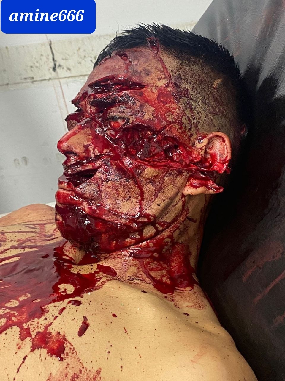 Machete Deaths are the Worst Deaths (Aftermath)