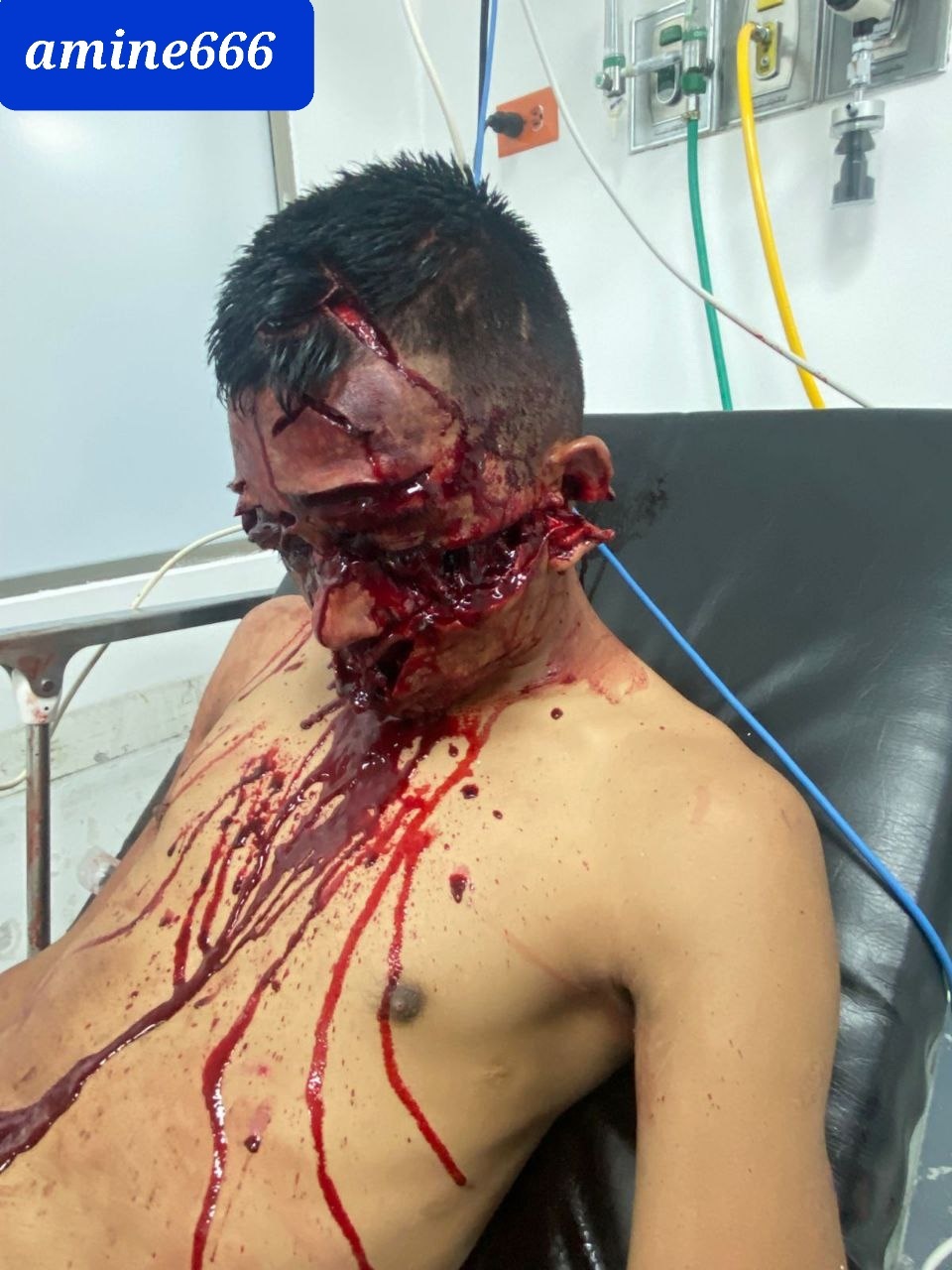 Machete Deaths are the Worst Deaths (Aftermath)