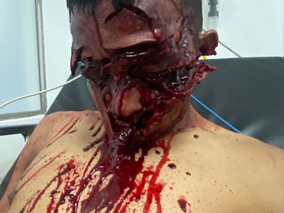 (Aftermath pics)machete death are the worst