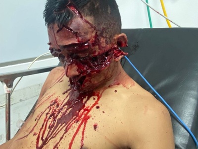 Machete Deaths are the Worst Deaths (Aftermath)