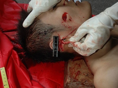 Autopsy of young Chinese man stabbed to death