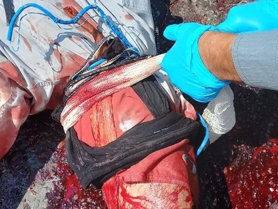 Motorcyclist lost his leg and still alive