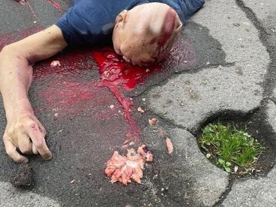 Old man lost the half of his head in horrific car crush