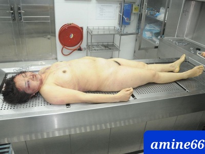 Examination a nude dead corps of ugly Chinese women