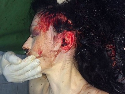 Depressed Chinese young woman commit suicide by jumping from balcony