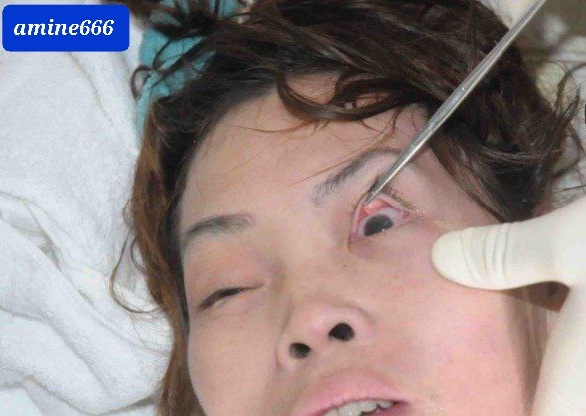 Woman Dies after 'Gas' Leak.