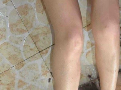 Woman dies after gaz leak in china