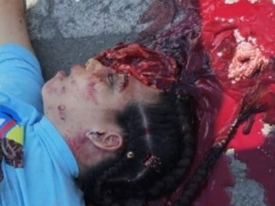 [BRAIN ON THE STREET] CUTE COLOMBIAN GIRL CRASHED BY TRUCK