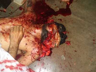 There were more than 30 shots and the last one was 12 in the head, inv