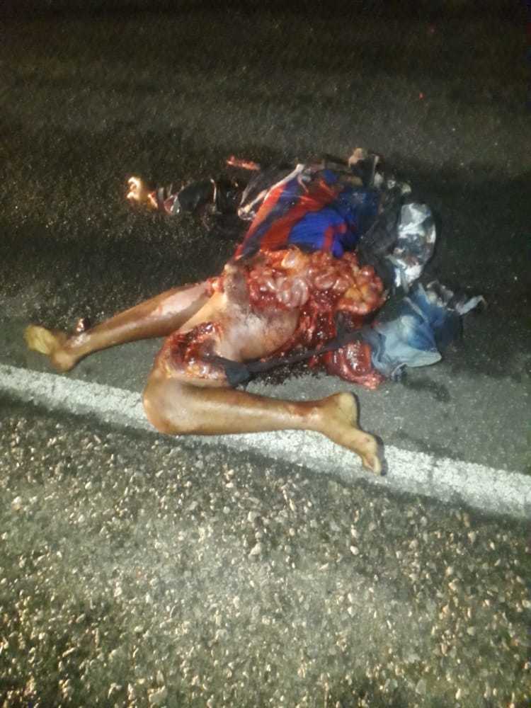 Brutal accident man totally shattered (photos)