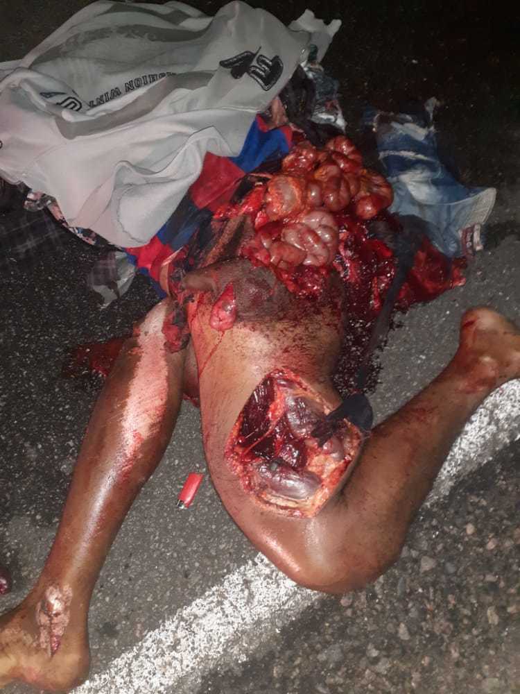 Brutal accident man totally shattered (photos)