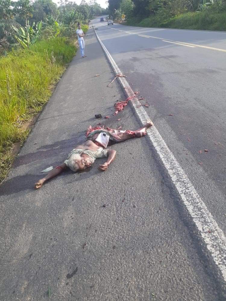 BRUTAL accident leaves a grandpa shattered.