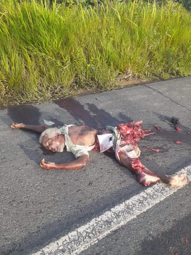 BRUTAL accident leaves a grandpa shattered.