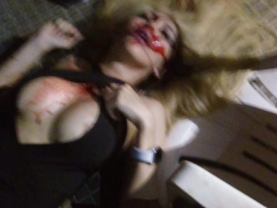 Pretty Call Girl Shot 4 Times