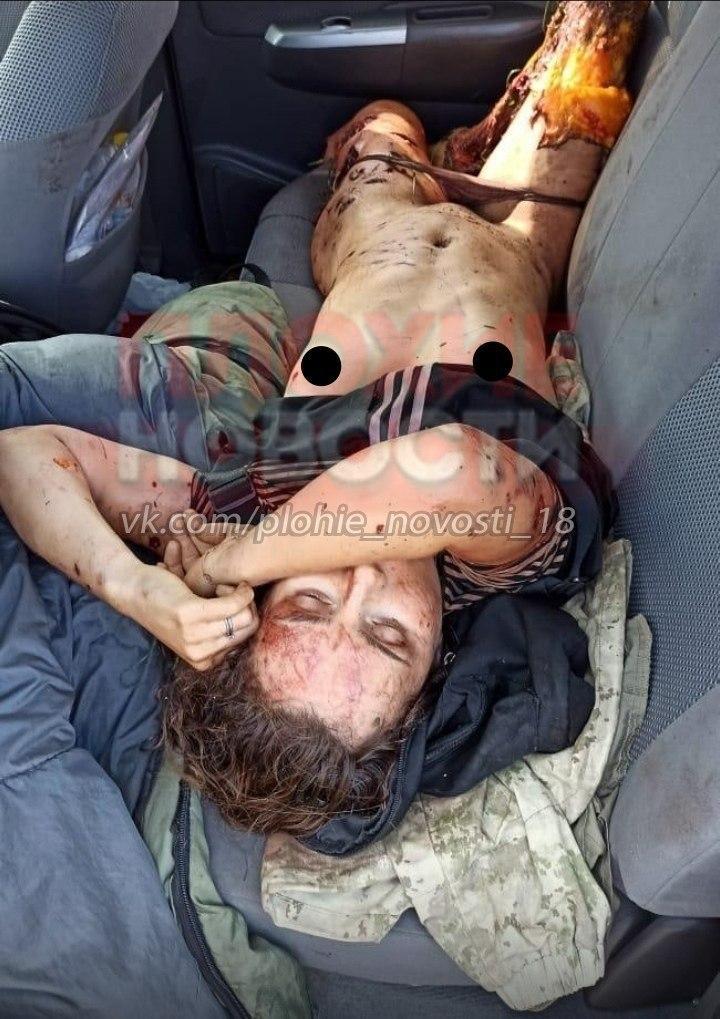 Terrible: the effects of a bear attack