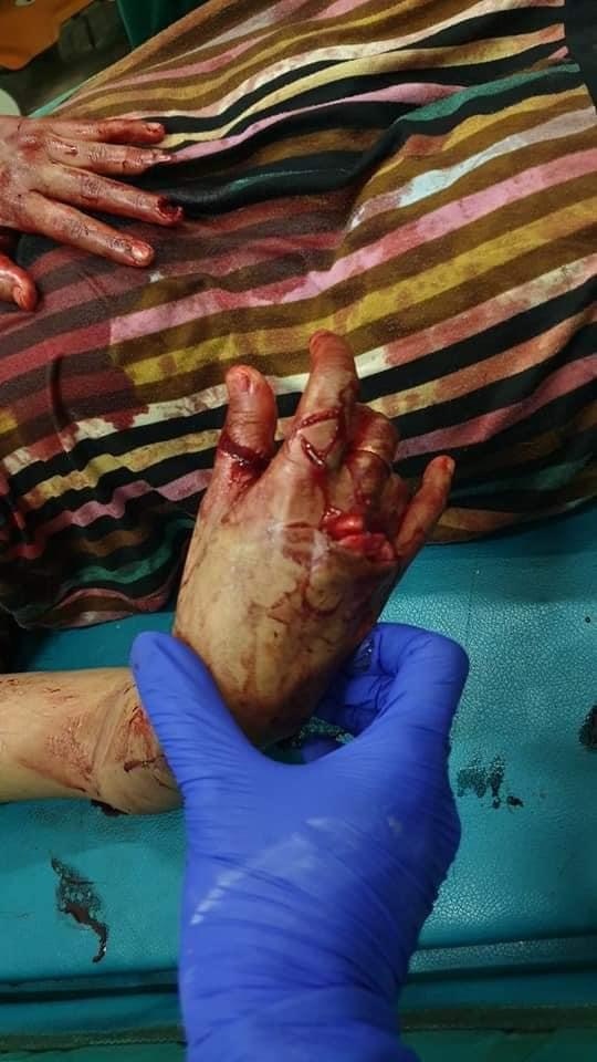 Bloody Violent Theft