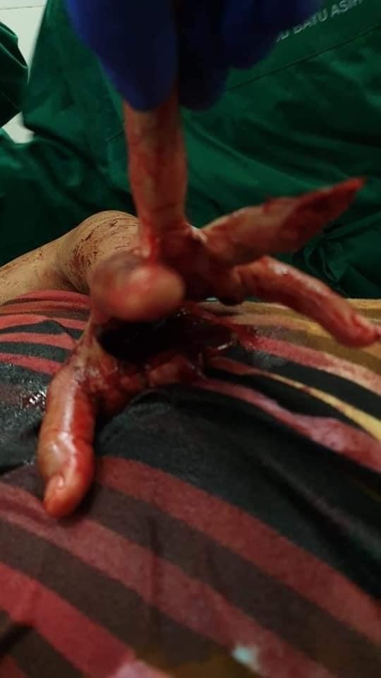 Bloody Violent Theft