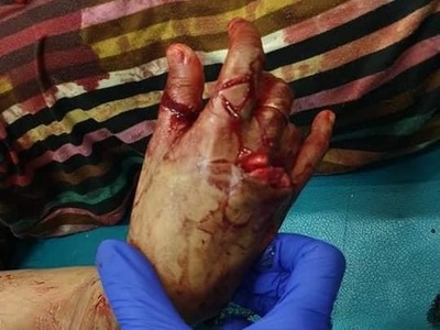 Bloody Violent Theft 