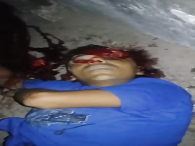 man victim of shots in street 