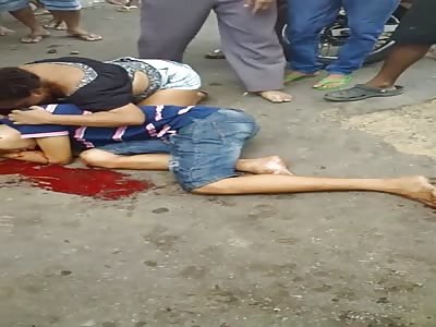 Agony ,boy injuried after shots