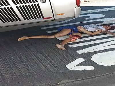 man victim of  accident in street