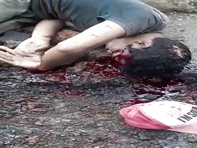 Victim of terrible accident 