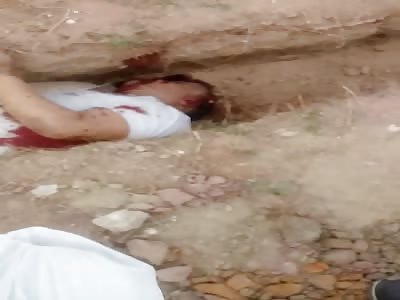 man victim of shots in head 