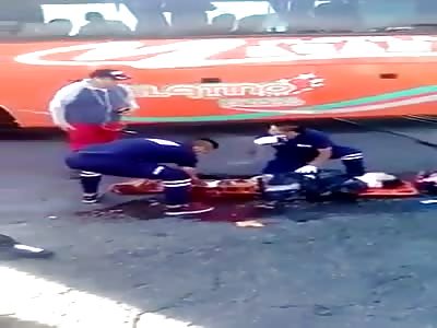 Woman with legs smashed 