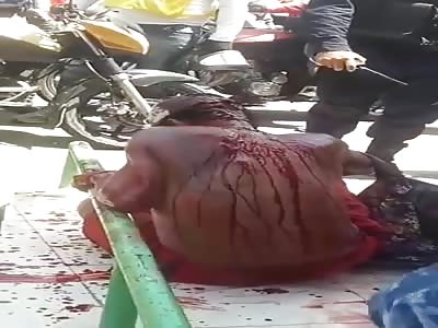 (Full VÃ­deo) man attacked with machete 