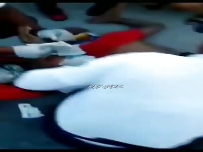 Man have cut leg in accident 