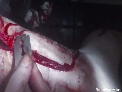 Skin sliver cutting from my thigh