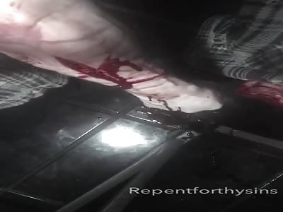 Artery cutting my arm