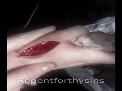 Aftermath: sliced my hand.