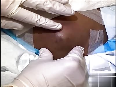 Shit's coming out of the ass