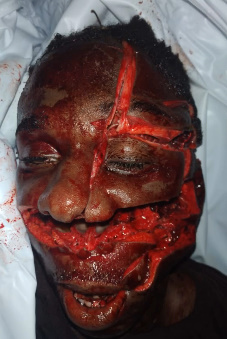 Goat thief butchered with machetes