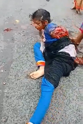 SHOCK: Ladies Arm is Fucked the Fuck Up!