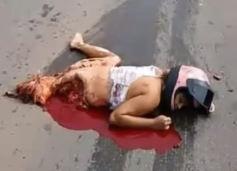 I'm No Doctor, but I Think You're Fucked