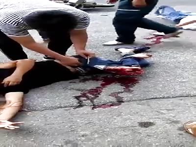 Man's leg severed in accident 